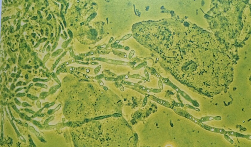 Bacteriën kunnen van alles veroorzaken.